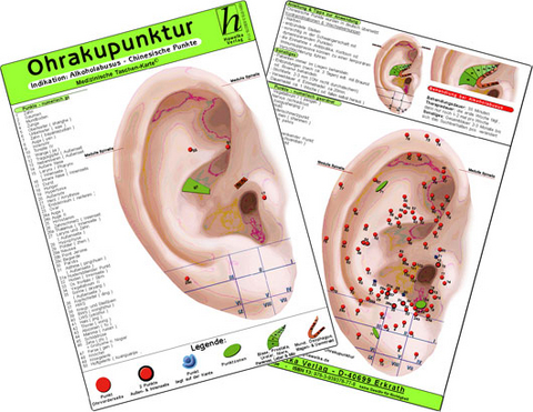 Ohrakupunktur - Indikation: Ekzem - chinesische Ohrakupunktur / Medizinische Taschen-Karte