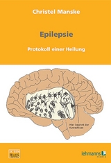 Epilepsie: Protokoll einer Heilung - Christel Manske